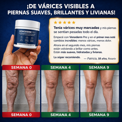 VENODERM PRO - Crema para Várices, Arañitas, Piernas Cansadas e Hidratación Profunda