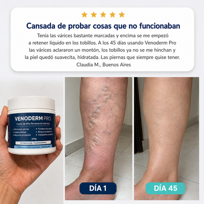 VENODERM PRO® — Recuperá tus piernas sanas, livianas e hidratadas