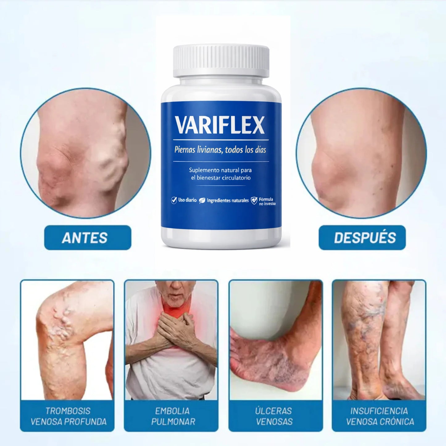 VARIFLEX - Recuperá tus piernas livianas sin várices ni arañitas